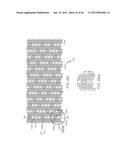 Stent diagram and image