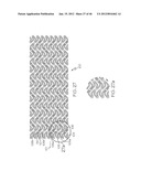 Stent diagram and image