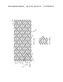 Stent diagram and image