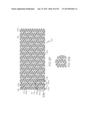 Stent diagram and image