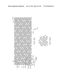 Stent diagram and image