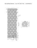 Stent diagram and image