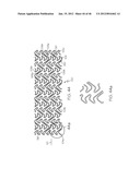 Stent diagram and image