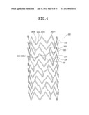 GUIDE WIRE AND STENT diagram and image