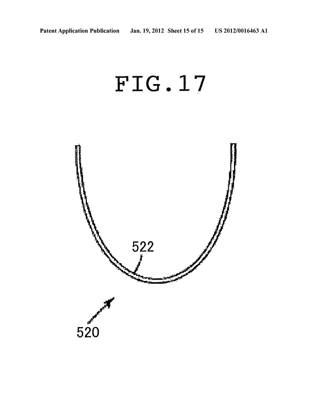 GUIDE WIRE AND STENT - diagram, schematic, and image 16