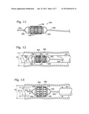 TRANSCATHETER HEART VALVE WITH MICRO-ANCHORS diagram and image