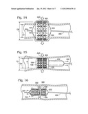 TRANSCATHETER HEART VALVE WITH MICRO-ANCHORS diagram and image