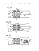 TRANSCATHETER HEART VALVE WITH MICRO-ANCHORS diagram and image