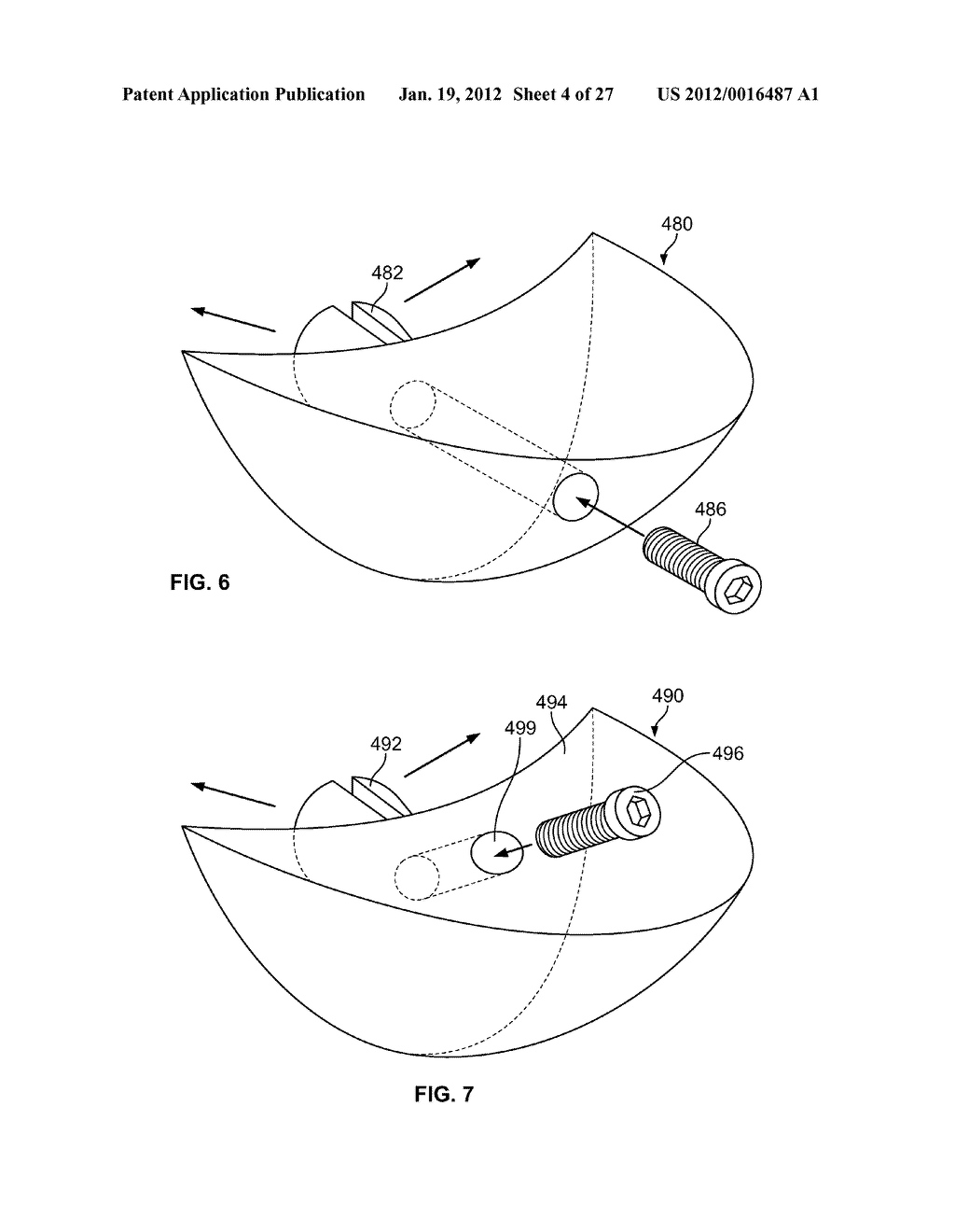 IMPLANT COMPONENTS AND METHODS - diagram, schematic, and image 05