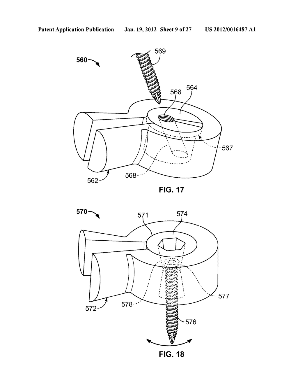 IMPLANT COMPONENTS AND METHODS - diagram, schematic, and image 10