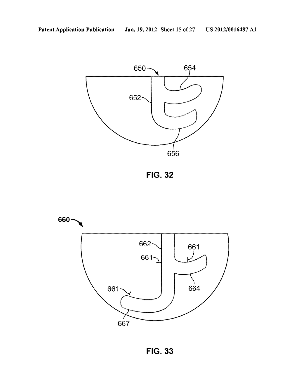 IMPLANT COMPONENTS AND METHODS - diagram, schematic, and image 16