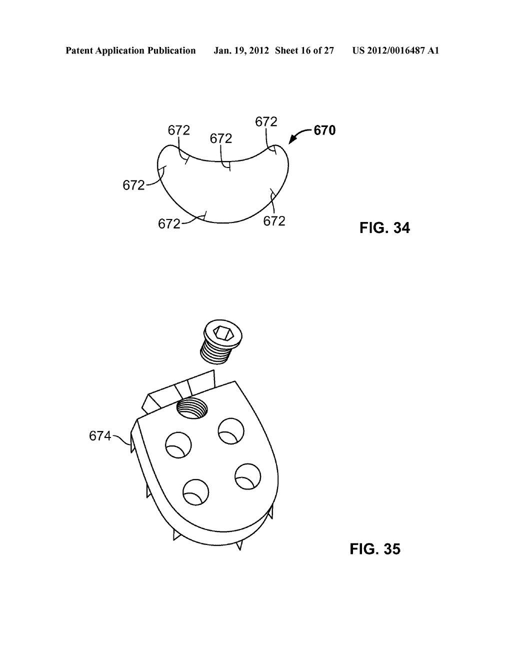 IMPLANT COMPONENTS AND METHODS - diagram, schematic, and image 17