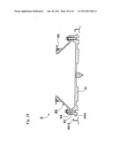 Surface Treatment Apparatus diagram and image