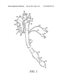 ENDOBRONCHIAL TUBE ASSEMBLIES AND SELECTORS diagram and image