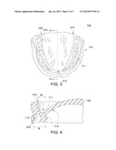 Oral Fixation Device and Fixing Method Using the Same diagram and image