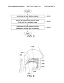 Oral Fixation Device and Fixing Method Using the Same diagram and image