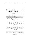 SECURITY ELEMENT COMPRISING MAGNETIC AREAS OF DIFFERENT COERCIVITIES, A     METHOD FOR ITS PRODUCTION AND A METHOD FOR READING INFORMATION ENCODED IN     THE ELEMENT diagram and image