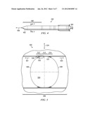 Fabric Preform Insert for a Composite Tank Y-Joint diagram and image