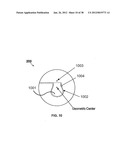 HIGH PERFORMANCE, LOW COST MULTIFOCAL LENS HAVING DYNAMIC PROGRESSIVE     OPTICAL POWER REGION diagram and image