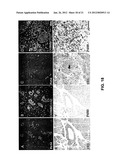 METHODS FOR PANCREATIC TISSUE REGENERATION diagram and image