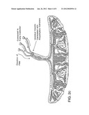 TREATMENT OF NEURODEGENERATIVE DISEASE USING PLACENTAL STEM CELLS diagram and image