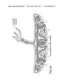 TREATMENT OF NEURODEGENERATIVE DISEASE USING PLACENTAL STEM CELLS diagram and image