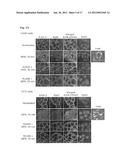 Methods for Inhibiting Cancer Cell Proliferation diagram and image