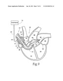 Method and Apparatus for Preventing Air Embolisms diagram and image