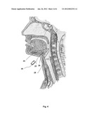 LARYNGOSCOPE, COMPRISING A SET OF MAGNETIC ELEMENTS diagram and image