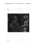 Chemically-selective, label free, microendoscopic system based on coherent     anti-stokes raman scattering and microelectromechanical fiber optic probe diagram and image