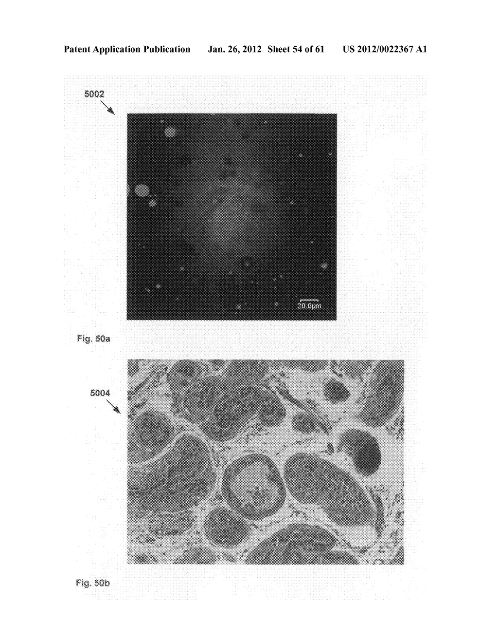 Chemically-selective, label free, microendoscopic system based on coherent     anti-stokes raman scattering and microelectromechanical fiber optic probe - diagram, schematic, and image 55