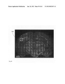 Chemically-selective, label free, microendoscopic system based on coherent     anti-stokes raman scattering and microelectromechanical fiber optic probe diagram and image