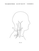 ENERGETIC MODULATION OF NERVES diagram and image