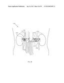 ENERGETIC MODULATION OF NERVES diagram and image