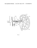 ENERGETIC MODULATION OF NERVES diagram and image