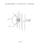 ENERGETIC MODULATION OF NERVES diagram and image