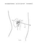 ENERGETIC MODULATION OF NERVES diagram and image