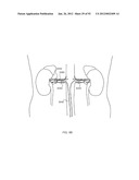 ENERGETIC MODULATION OF NERVES diagram and image