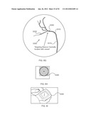 ENERGETIC MODULATION OF NERVES diagram and image