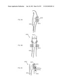 ENERGETIC MODULATION OF NERVES diagram and image