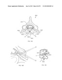 ENERGETIC MODULATION OF NERVES diagram and image