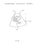 ENERGETIC MODULATION OF NERVES diagram and image