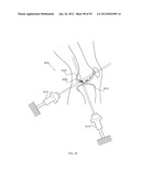 ENERGETIC MODULATION OF NERVES diagram and image