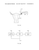 ENERGETIC MODULATION OF NERVES diagram and image