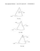 ENERGETIC MODULATION OF NERVES diagram and image