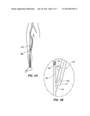 BYPASS VASCULAR GRAFT diagram and image