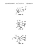 BYPASS VASCULAR GRAFT diagram and image