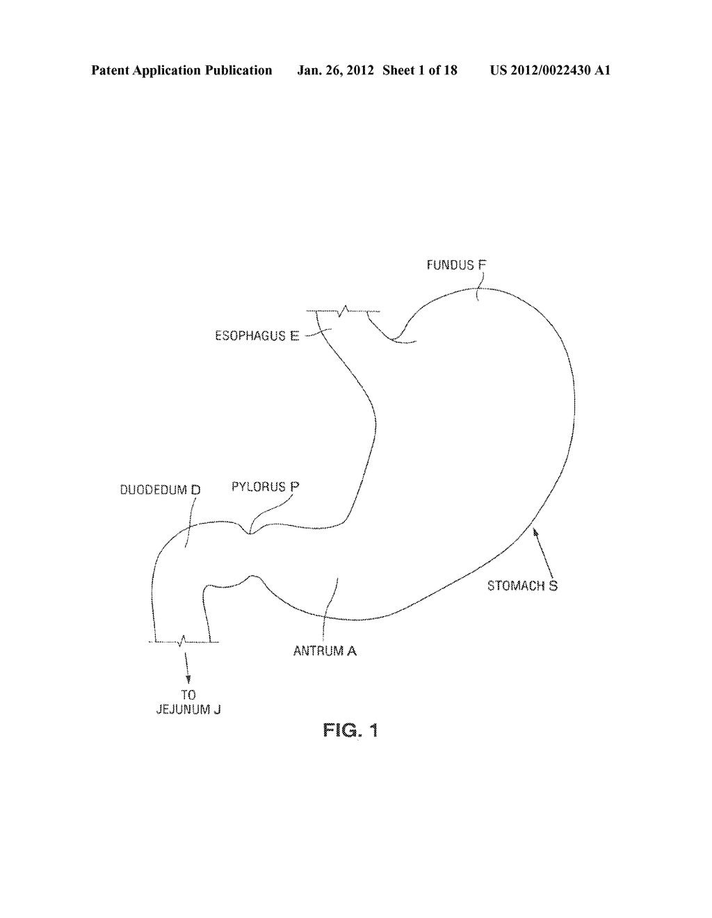 SATIATION DEVICES AND METHODS - diagram, schematic, and image 02