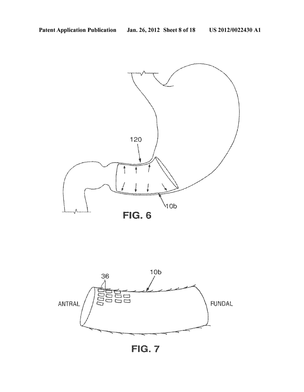 SATIATION DEVICES AND METHODS - diagram, schematic, and image 09