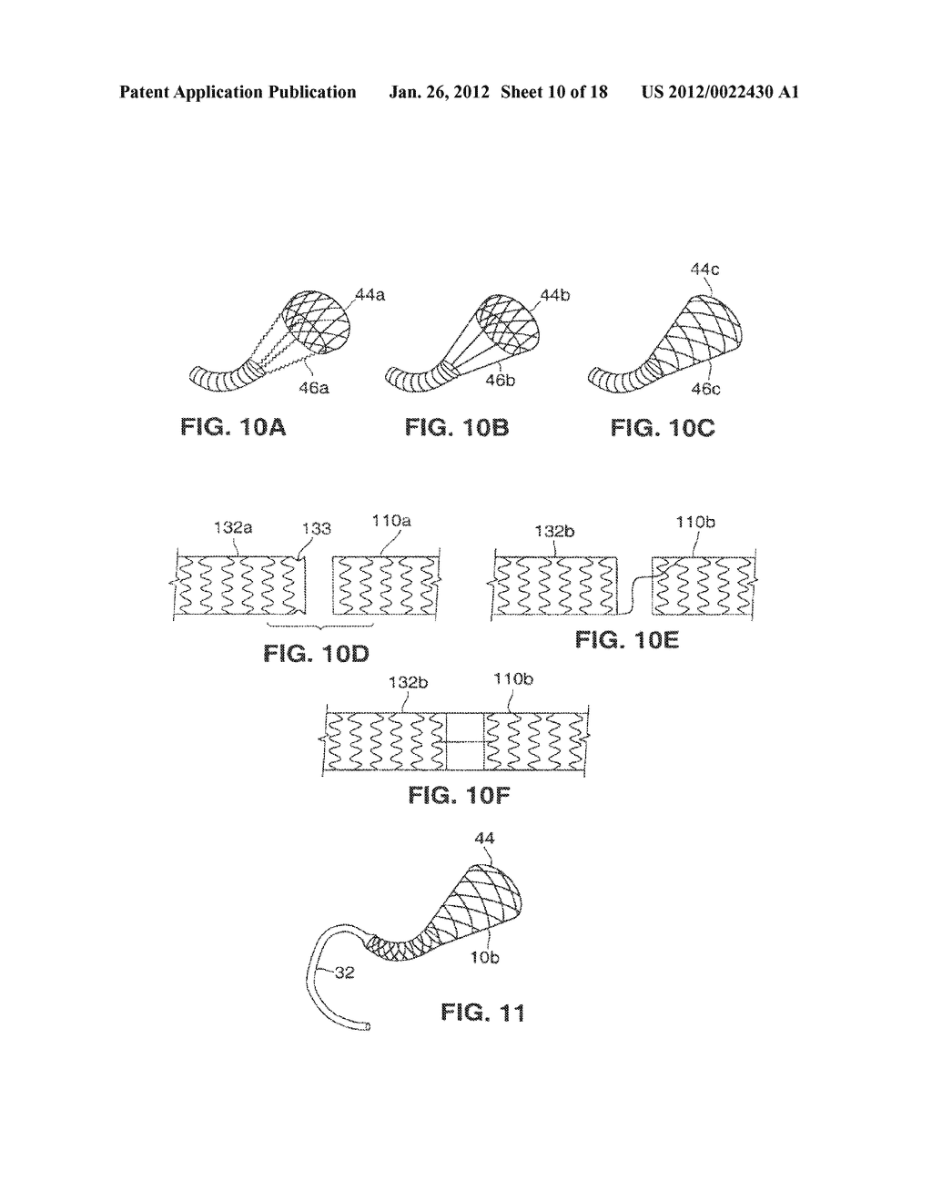 SATIATION DEVICES AND METHODS - diagram, schematic, and image 11